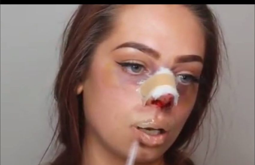 Plastic Surger Special Effects Halloween Make Up