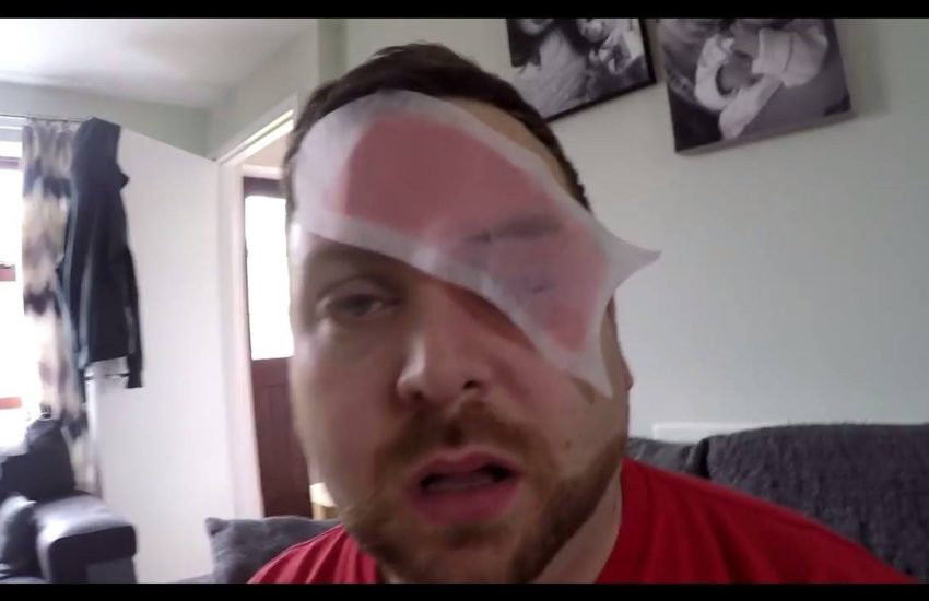 Girlfriend Slaps Wax Strip On Boyfriend's Eyebrow