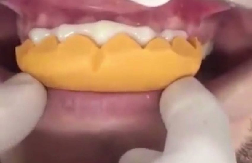 Amazing material shows what your teeth would look like if they...