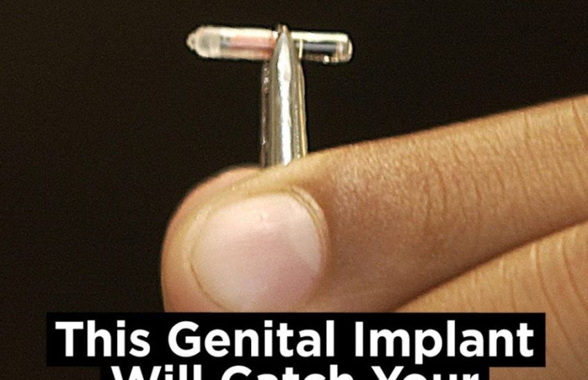 This Genital Implant Will Catch Your Cheating Partner