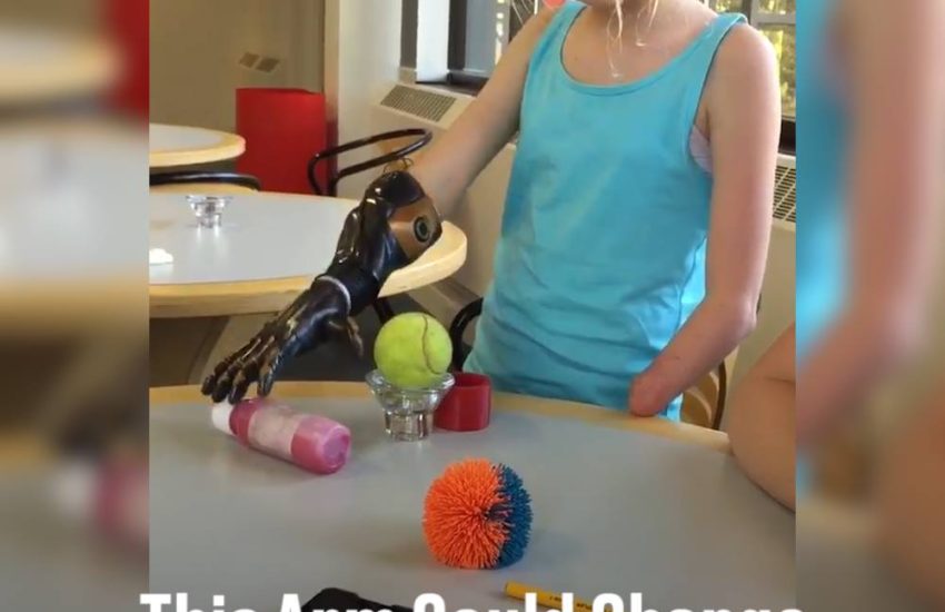 This Arm Could Change The Lives Of Amputee Children
