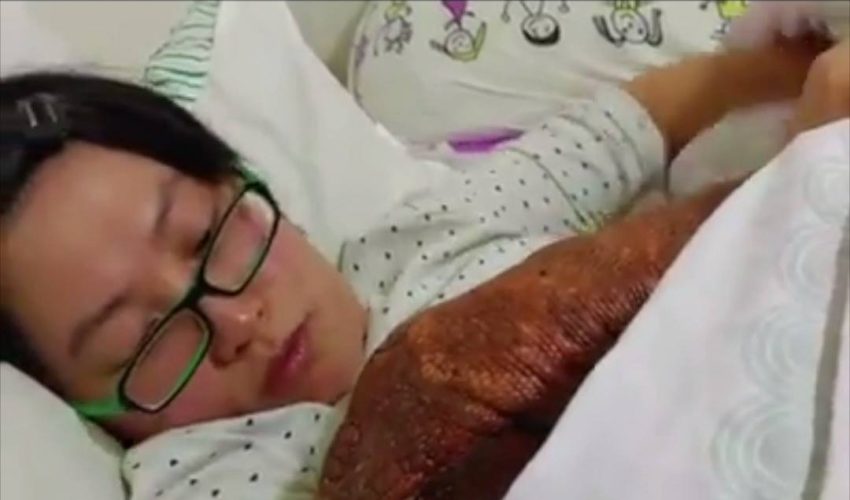 女人擁抱蜥蜴